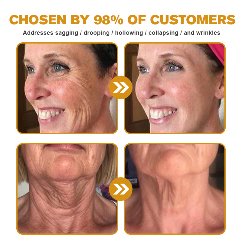 Mubi Botox Bee Venom Rynkefjerning Krem
