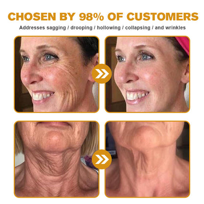 Mubi Botox Bee Venom Rynkefjerning Krem