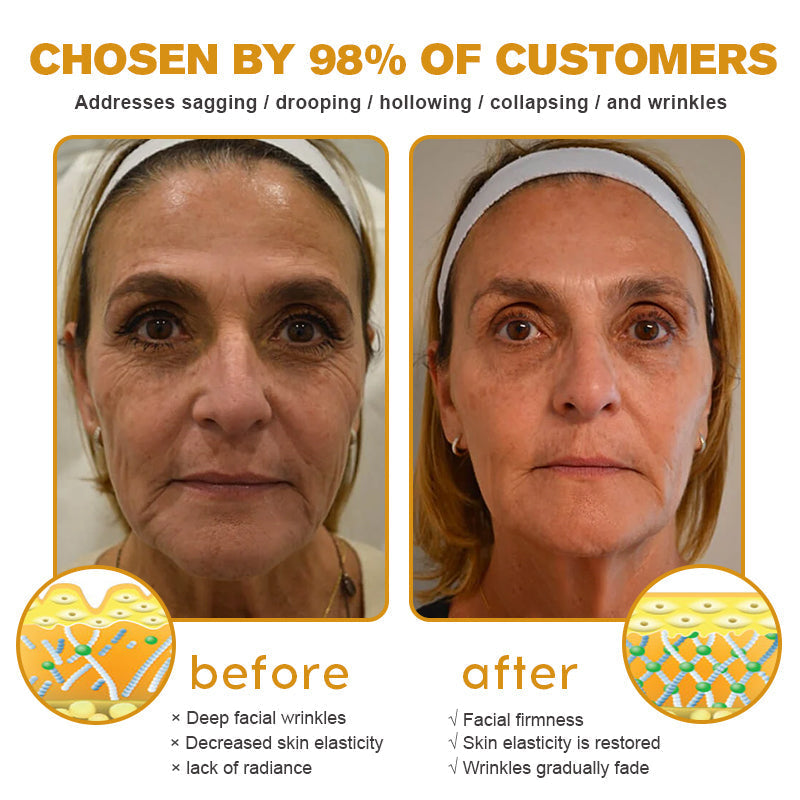 Mubi Botox Bee Venom Rynkefjerning Krem