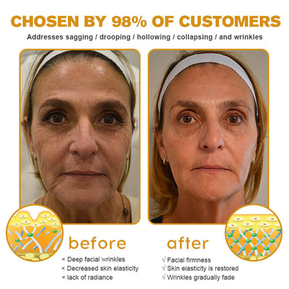 Mubi Botox Bee Venom Rynkefjerning Krem
